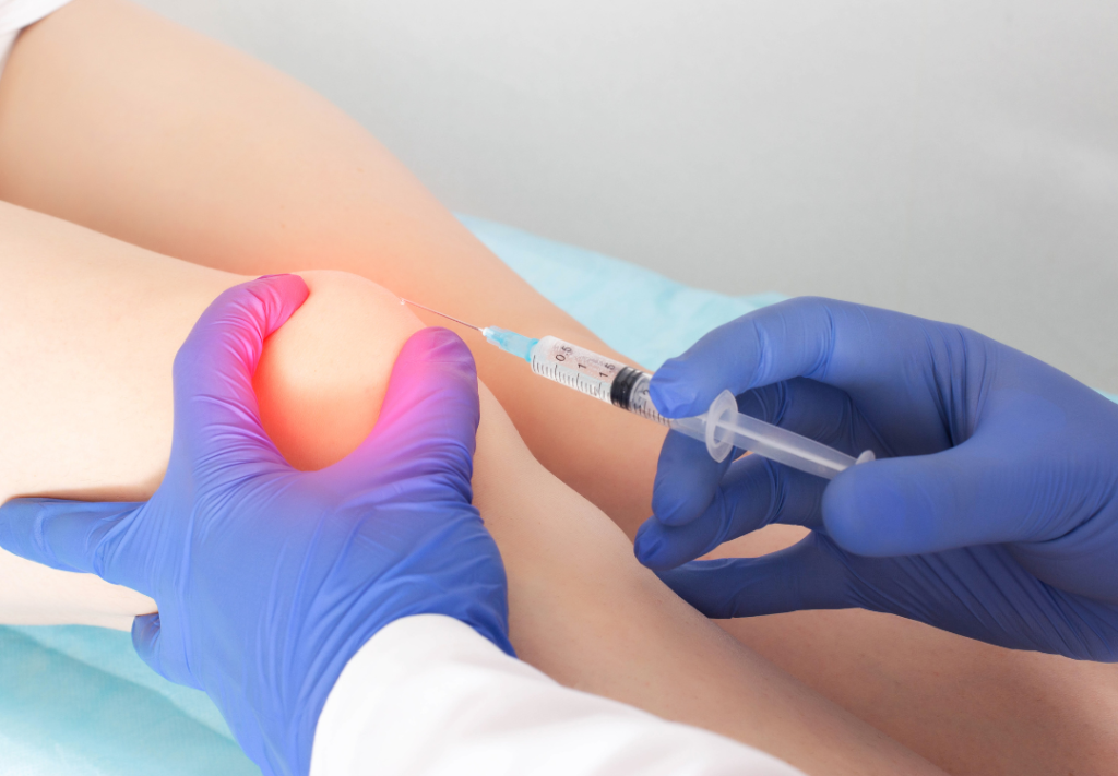 Corticosteroid injection given by physician in the knee for pain relief